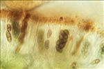 Physcia clementei