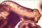 Physcia clementei