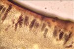 Physcia clementei