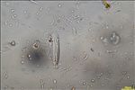 Opegrapha vulgata