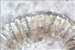 Lecidella elaeochroma