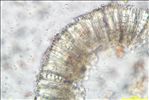 Lecidella elaeochroma