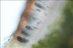 Hyperphyscia adglutinata