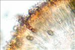Hyperphyscia adglutinata