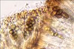 Hyperphyscia adglutinata